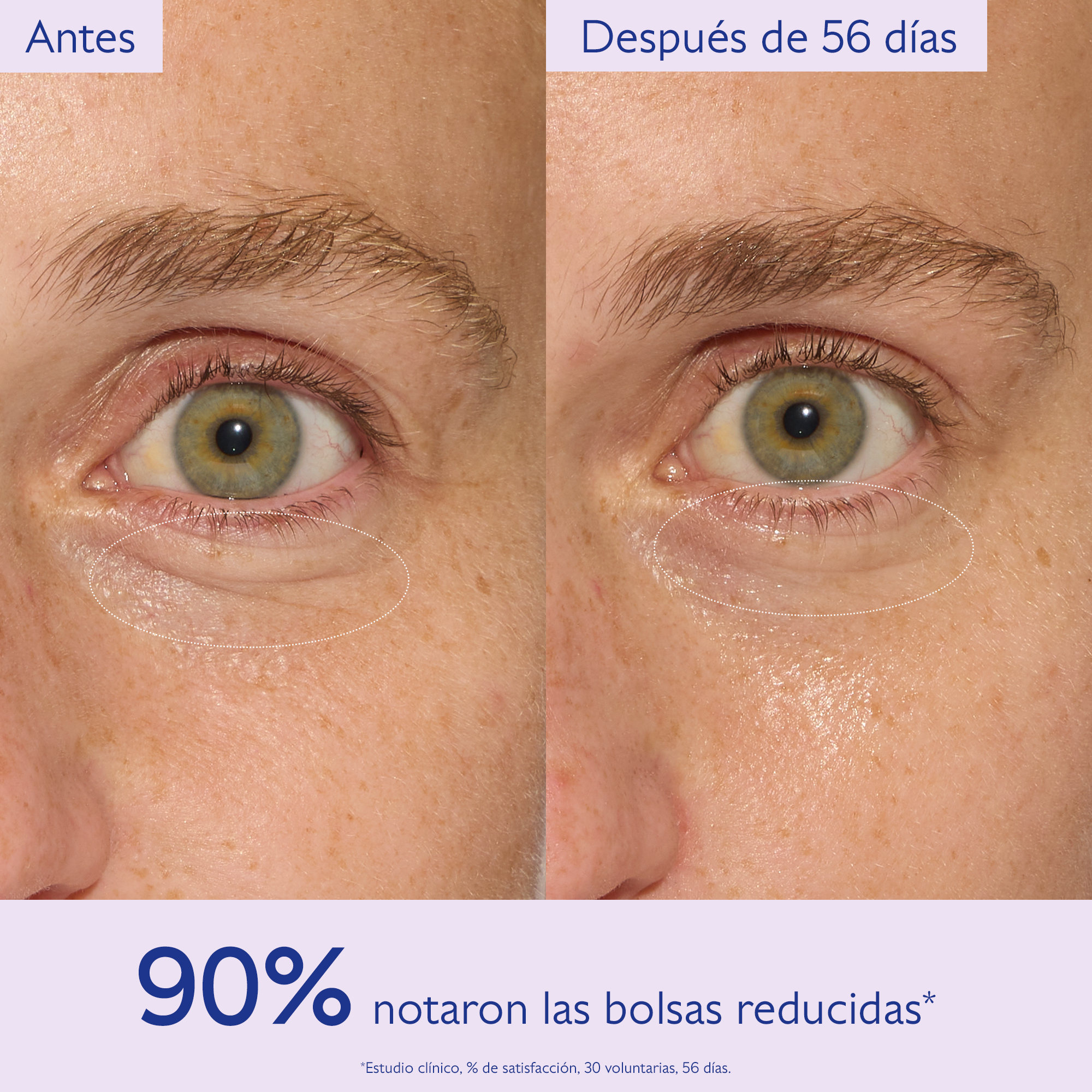RESVERATROL-LIFT EYE GEL (CREMA REAFIRMANTE DE OJOS)